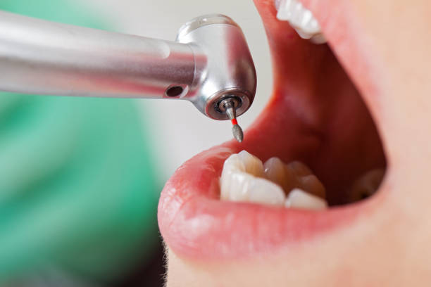 Best Cracked Tooth Emergency Dentist  in Willows, CA